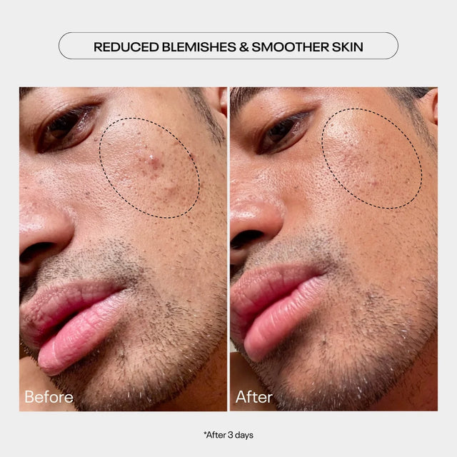 aha moment resurfacing serum