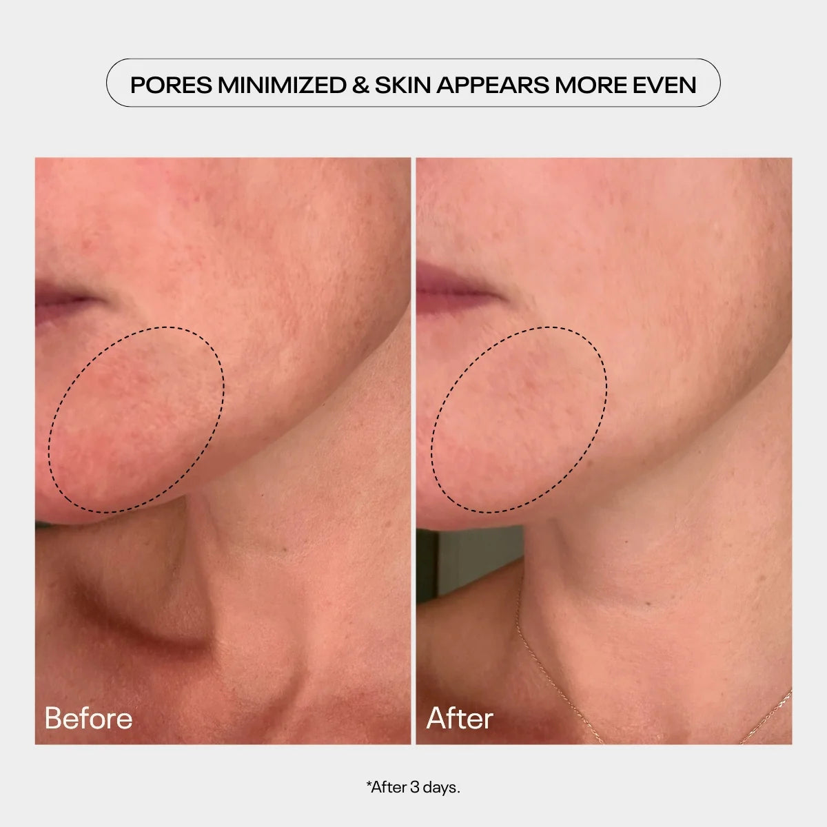 aha moment resurfacing serum
