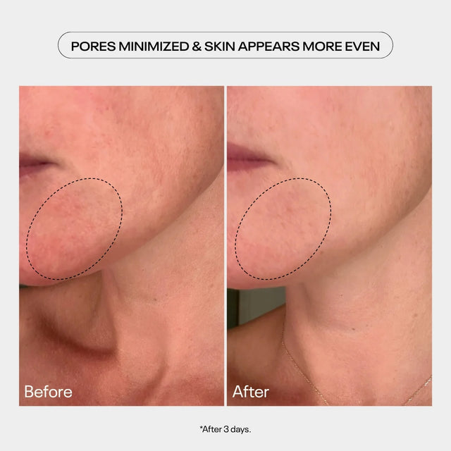 aha moment resurfacing serum