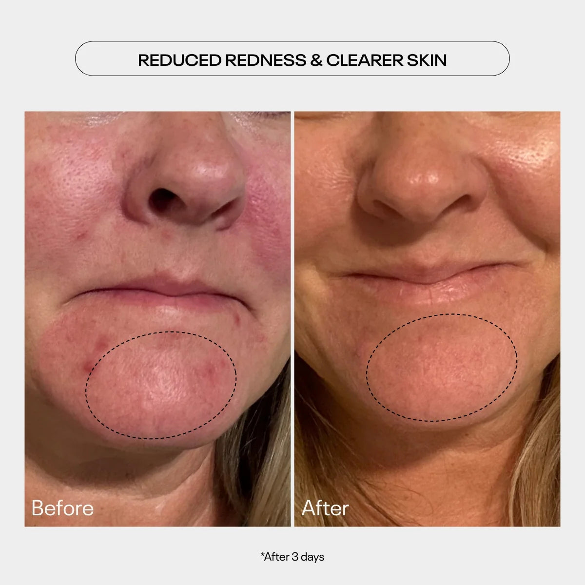 aha moment resurfacing serum