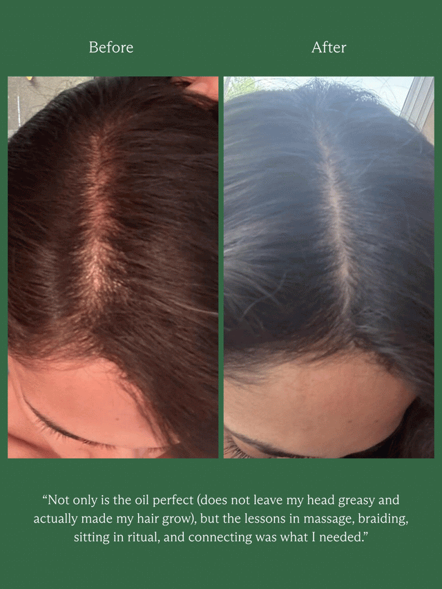 HINU HAIR GROWTH OIL