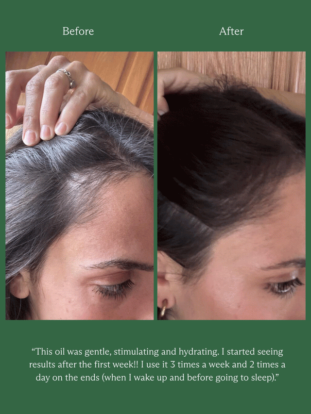 HINU HAIR GROWTH OIL