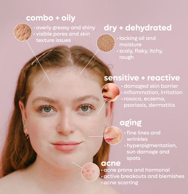 OPTIMYST MINERALIZING SPRAY