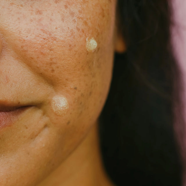 CLEAR IT SPOT TREATMENT